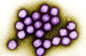 Virus’s ‘taste’ for unusual sugar could lead to new cancer treatments Viruss taste for unusual sugar could lead to new cancer treatments