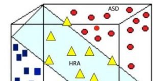 EEG signals accurately predict autism as early as 3 months of age
