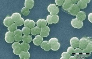 Iron-silica particles unlock part of the mystery of Earth’s oxygenation Iron silica particles unlock part of the mystery of Earths oxygenation
