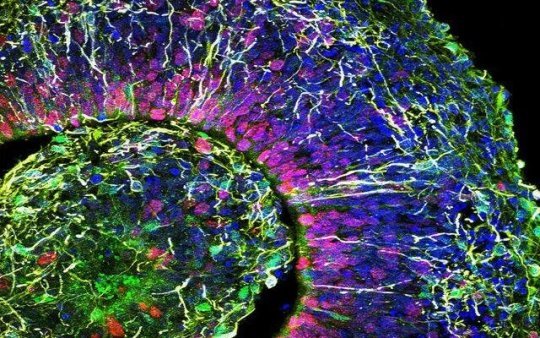 Building a better brain in a dish faster and cheaper