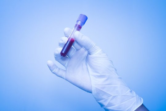 A new approach to detecting cancer earlier from blood tests