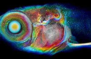 Increase in resolution, scale takes CT scanning and diagnosis to the next level Increase in resolution scale takes CT scanning and diagnosis to the next level