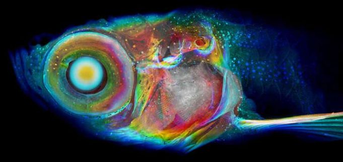 Increase in resolution, scale takes CT scanning and diagnosis to the next level Increase in resolution scale takes CT scanning and diagnosis to the next level