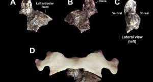Oldest axial fossils discovered for the genus Australopithecus