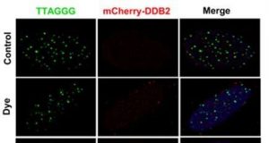 Molecular sensor scouts DNA damage and supervises repair