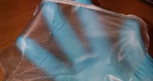 Synthetic skin could aid wound healing