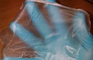 Synthetic skin could aid wound healing Synthetic skin could aid wound healing