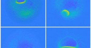 Worlds smallest MRI performed on single atoms
