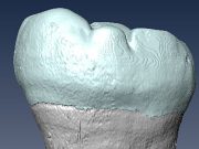 cropped Ancient molar points to interbreeding between archaic humans and Homo sapiens in Asia