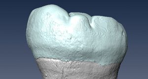 cropped Ancient molar points to interbreeding between archaic humans and Homo sapiens in Asia
