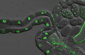 Living longer or healthier? Genetic discovery in worms suggests they can be separated cropped Genetic discovery in worms suggests they can be separated