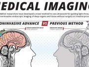 cropped ultrasoundas