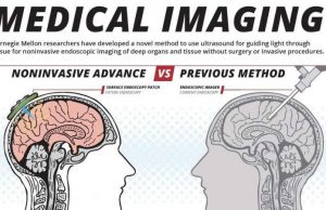 Ultrasound-assisted optical imaging to replace endoscopy in breakthrough discovery cropped ultrasoundas