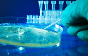 How E. coli knows how to cause the worst possible infection How E. coli knows how to cause the worst possible infection