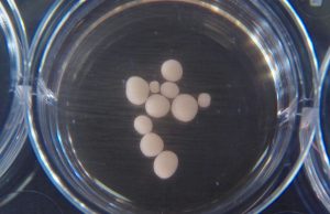 Brain waves detected in mini-brains grown in a dish brainwavesde