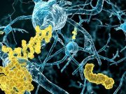 cropped An alternate theory for what causes Alzheimers disease