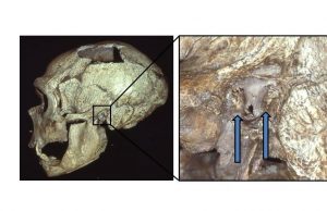 Neanderthals also got ‘surfer’s ear,’ suggesting they liked to fish cropped Neanderthals also got surfers ear suggesting they liked to fish