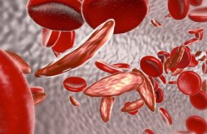 Targeting a blood stem cell subset shows lasting, therapeutically relevant gene editing cropped Targeting a blood stem cell subset shows lasting therapeutically relevant gene editing