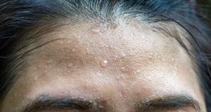 cropped Wearable sensors detect whats in your sweat