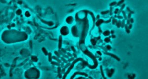 cropped Cause of antibiotic resistance identified