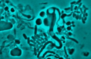 Cause of antibiotic resistance identified cropped Cause of antibiotic resistance identified