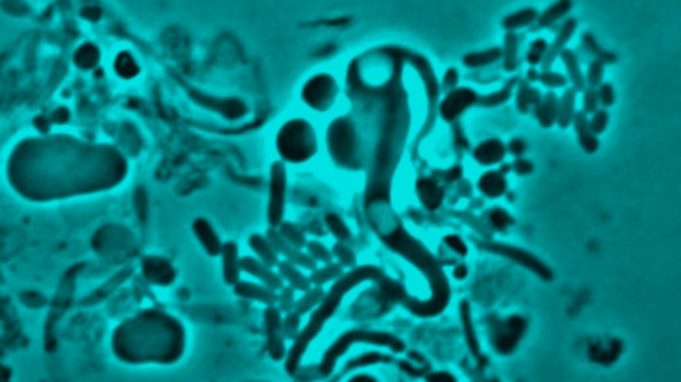 Cause of antibiotic resistance identified cropped Cause of antibiotic resistance identified