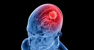 cropped Delivering immunotherapy directly to brain tumor
