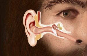 Did a common childhood illness take down the Neanderthals? cropped Did a common childhood illness take down the Neanderthals