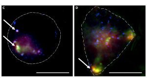 cropped Nanoparticles used to transport anti cancer agent to cells
