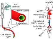 3 D printing bioinks create implantable blood vessels