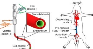 3 D printing bioinks create implantable blood vessels