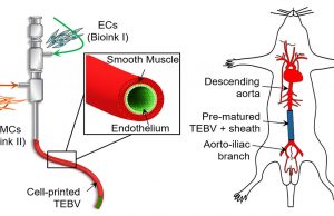 3 D printing bioinks create implantable blood vessels