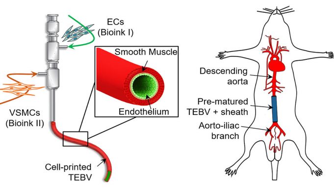 3-D printing, bioinks create implantable blood vessels 3 D printing bioinks create implantable blood vessels