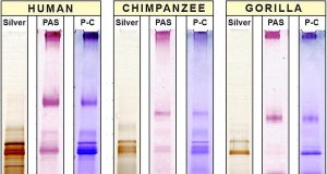 A secret in saliva Food and germs helped humans evolve into unique member of great apes