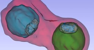 Malaria pathogen under the X ray microscope