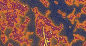 To survive in the human gut bacteria need genetic passcode