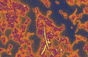 To survive in the human gut bacteria need genetic passcode
