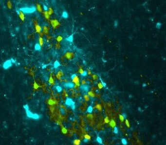 cropped Implanted memories teach birds a song