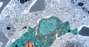 Magnesium deprivation stops pathogen growth scaled