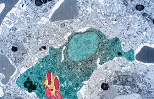 Magnesium deprivation stops pathogen growth scaled