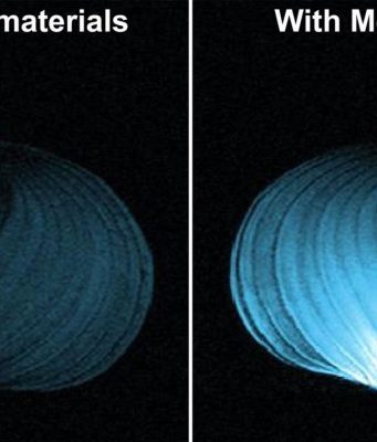 Researchers design intelligent metamaterial to make MRIs affordable and accessible
