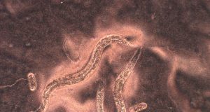Researchers sequence genome of the devil worm scaled
