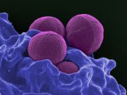 Scientists discover how potent bacterial toxin kills MRSA bacteria