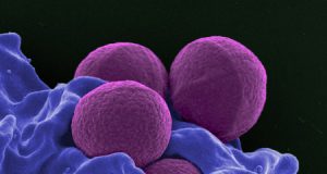 Scientists discover how potent bacterial toxin kills MRSA bacteria