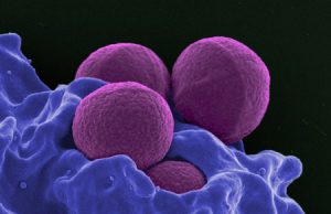 Scientists discover how potent bacterial toxin kills MRSA bacteria