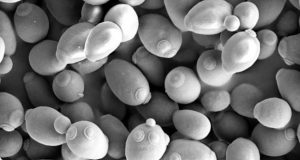 All pilsner yeast strains originate from a single yeast ancestor