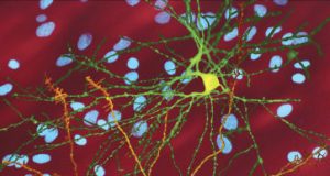 Ancient worm reveals way to destroy toxic cells in Huntingtons disease