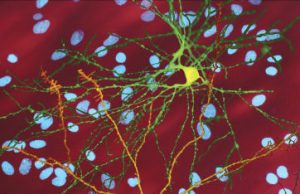 Ancient worm reveals way to destroy toxic cells in Huntington’s disease Ancient worm reveals way to destroy toxic cells in Huntingtons disease