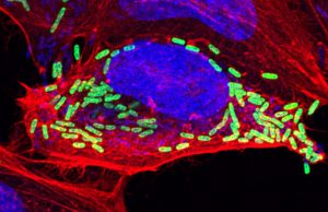 Bacteria can ‘outsmart’ programmed cell death Bacteria can outsmart programmed cell death