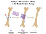 Bone bandage soaks up pro healing biochemical to accelerate repair